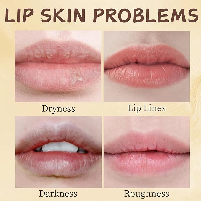 5PCS Bee Lip Balm Honey Pot - Lip Sleeping Mask - Moisturizing Lip Gloss for Women - Lip Mask Overnight Gift Set - Tinted Lip Balm - lip balm Hydrating - Honey,Cherry,Strawberry,Apple Lime,Watermelon