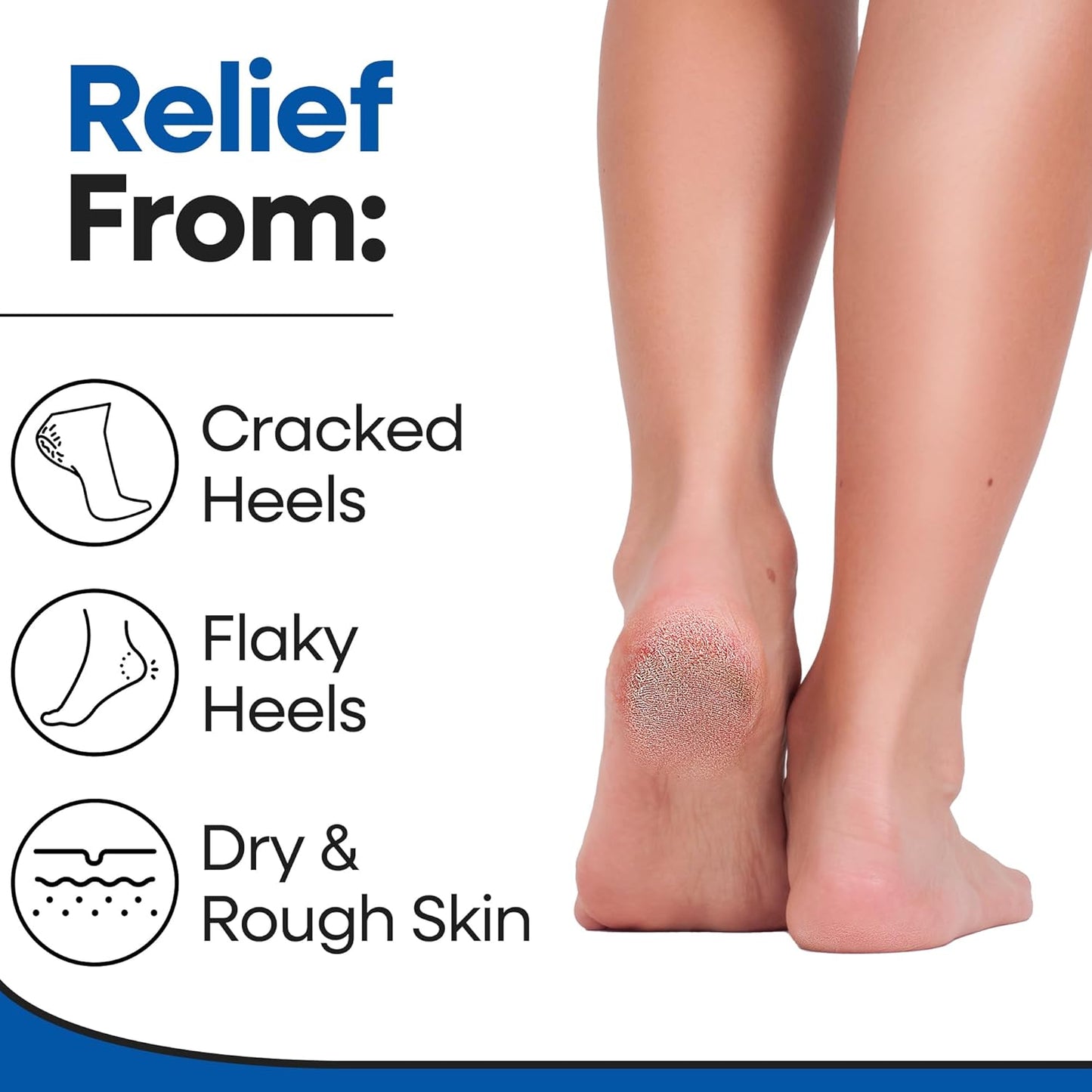 Moisturizing Socks for Mens Cracked Heels - Moisturizer Heel Sleeves to Smooth & Soften Rough Cracked Heels & Dry Feet. Large Aloe Moisturizing Heel Socks (White - 3 Pairs, Large)