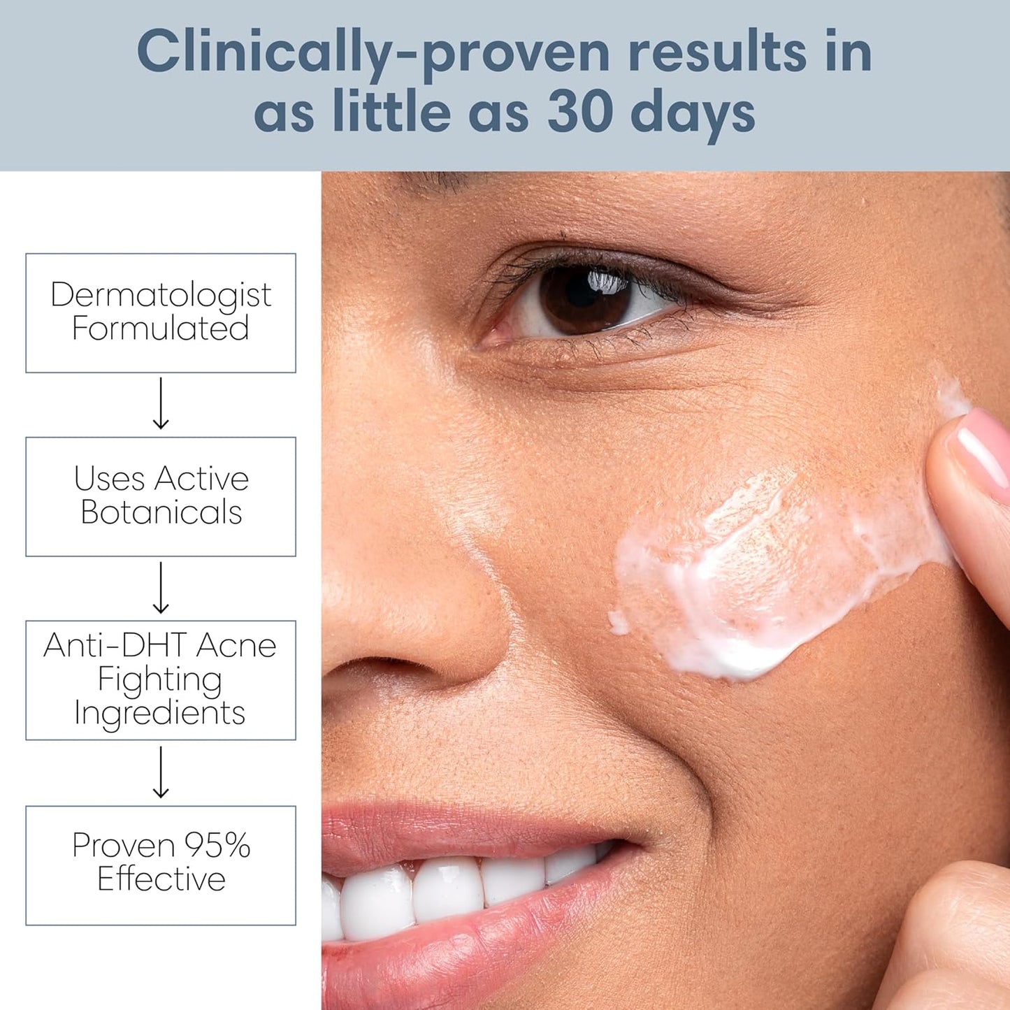 Acne Lotion with Benzoyl Peroxide, Acne Cream, Face Moisturizer Acne Prone Skin, Acne Moisturizer for Face, 1.8 Fl oz