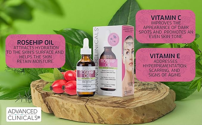Advanced Clinicals Rosehip Oil For Face With Vitamin E + Botanicals Helps Improve Look Of Dark Spots, Wrinkles, Fine Lines, & Uneven Looking Skin Tone | Moisturizing Skin Care Face Serum, 2-Pack
